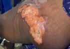 Former Benue councillor remanded over alleged torture, attempted murder of woman
