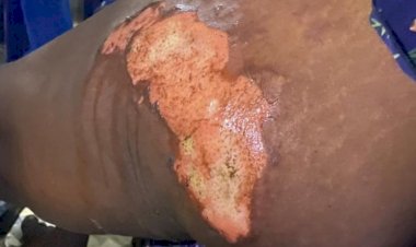 Former Benue councillor remanded over alleged torture, attempted murder of woman