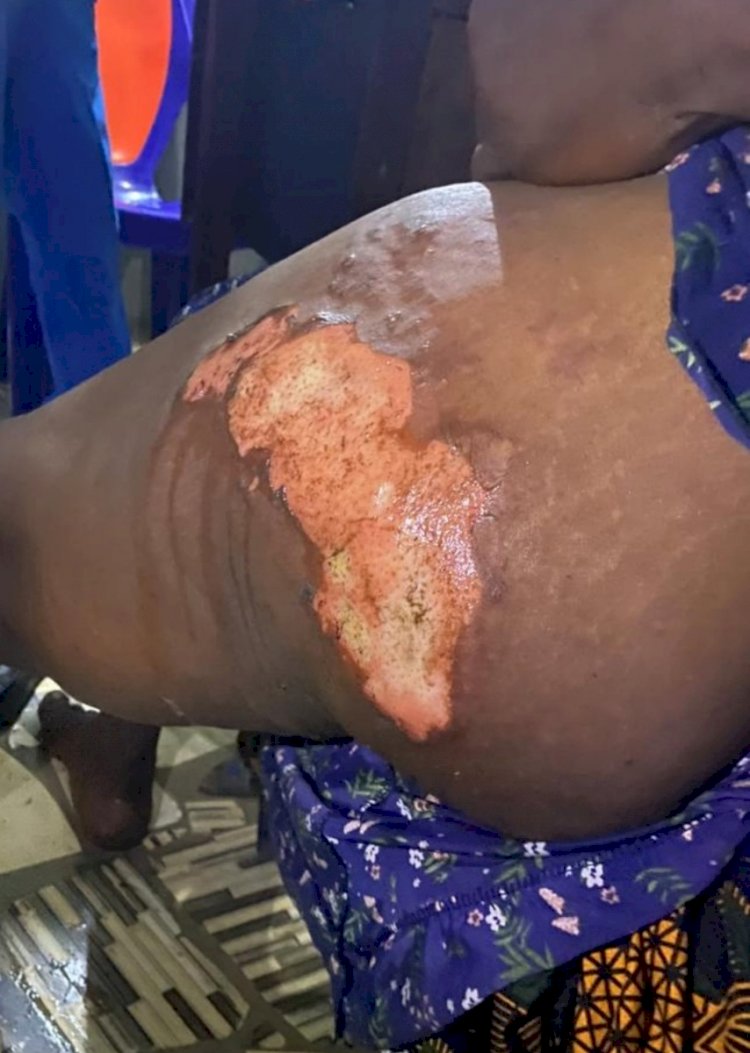 Former Benue councillor remanded over alleged torture, attempted murder of woman